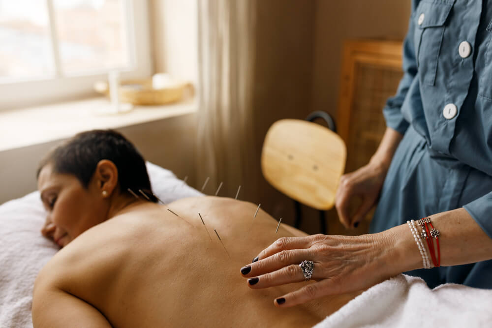 bienfaits de l'acupuncture